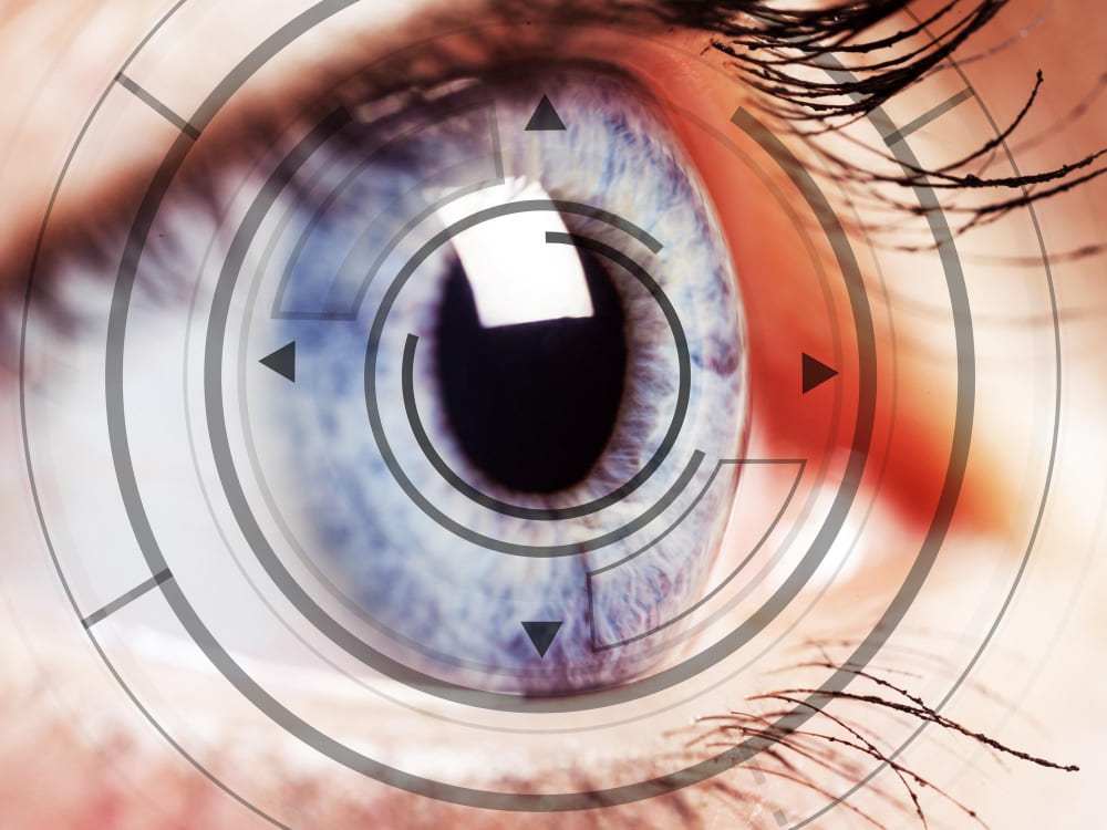 Médico Oftalmólogo para Problemas de Córnea